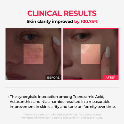 Dr. Melaxin TX-Astaxanthin Overnight Wrapping Mask - Clinical Results: Skin clarity improved by 100.75%
