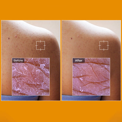 TX-Kojic Acid Turmeric Toner Pad how to use