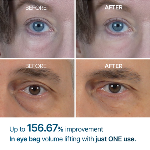 Dr. Melaxin EYEPHALT EP Eyebag Cream - clinical results